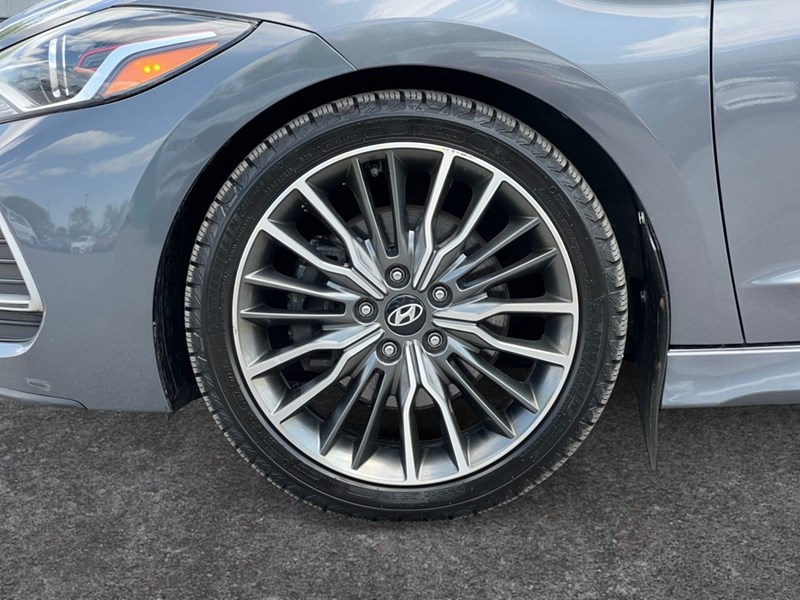 2018 Hyundai Elantra Sport Tech DCT
